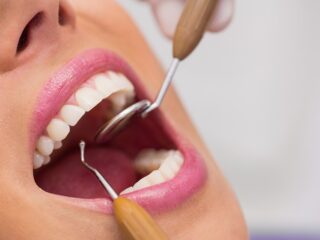 Endodontie - Upgrade Dental
