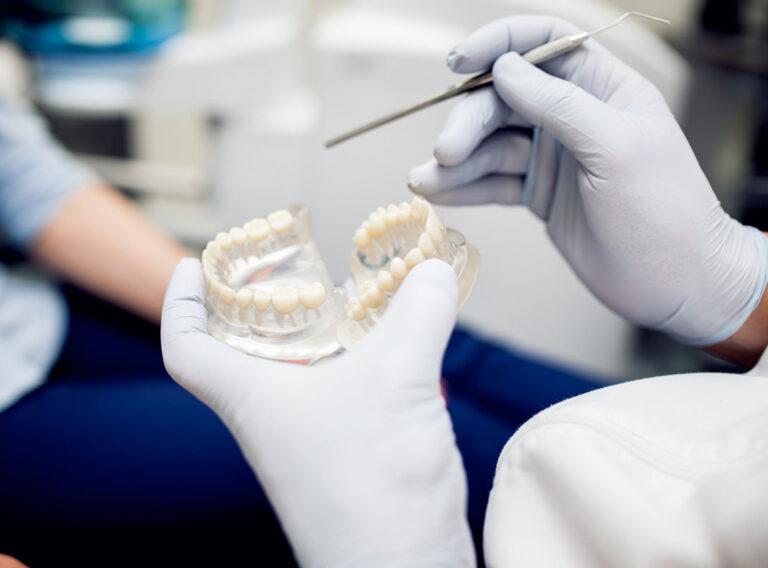 Recuperarea Dupa Implant Dentar
